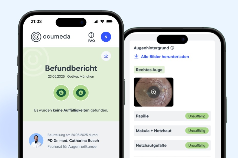 Ocumeda: Befundbericht auf dem Handy